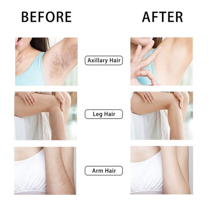 Crystal Hair Eraser - Epilator with crystal for painless hair removal